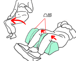 ナーセント・アップニー使用例。両下肢が片側に倒れ込む方。アップニーに下肢を乗せます。この時、ひざが倒れる側にアップニーの凸部を合わせてセットします。尖足(=せんそく)予防のクッションを足底にセットしてください。